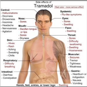 Tramadol